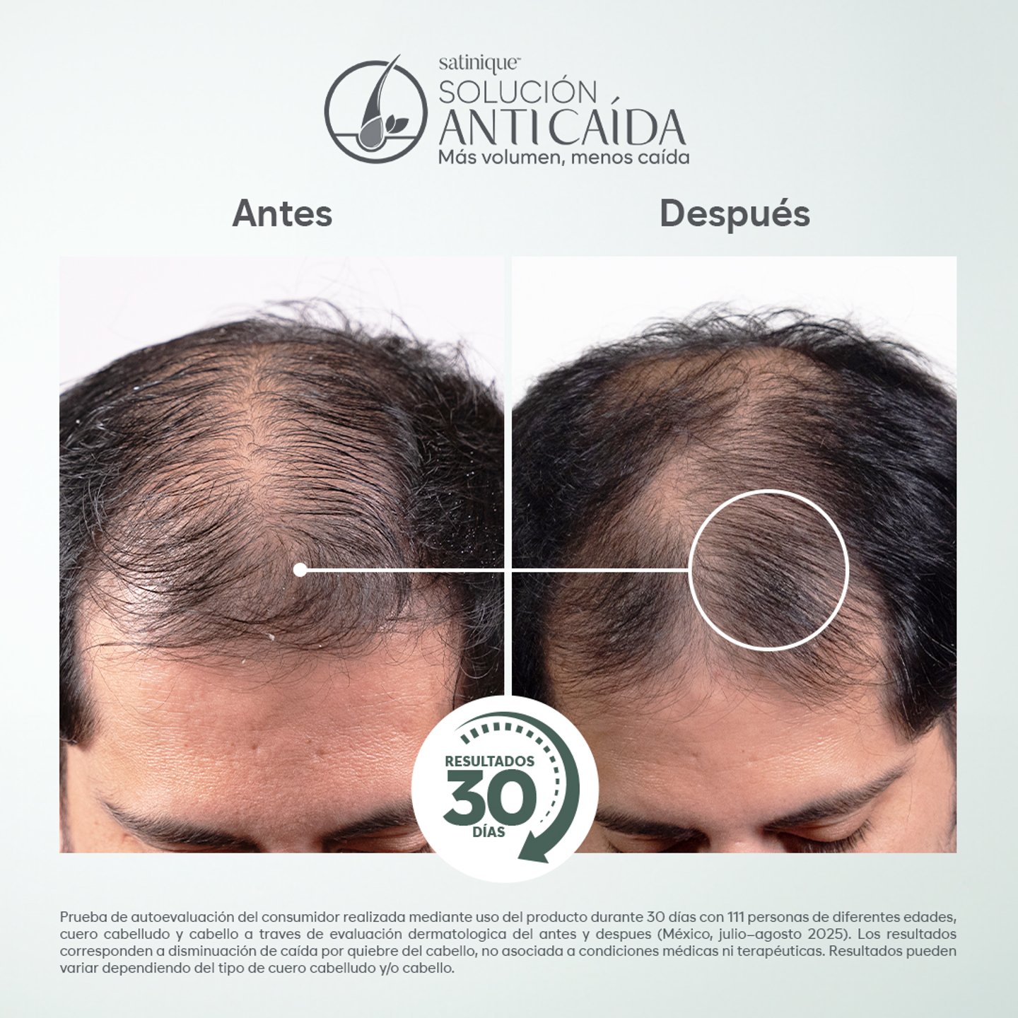 Antes y Después Solución anticaída Satinique